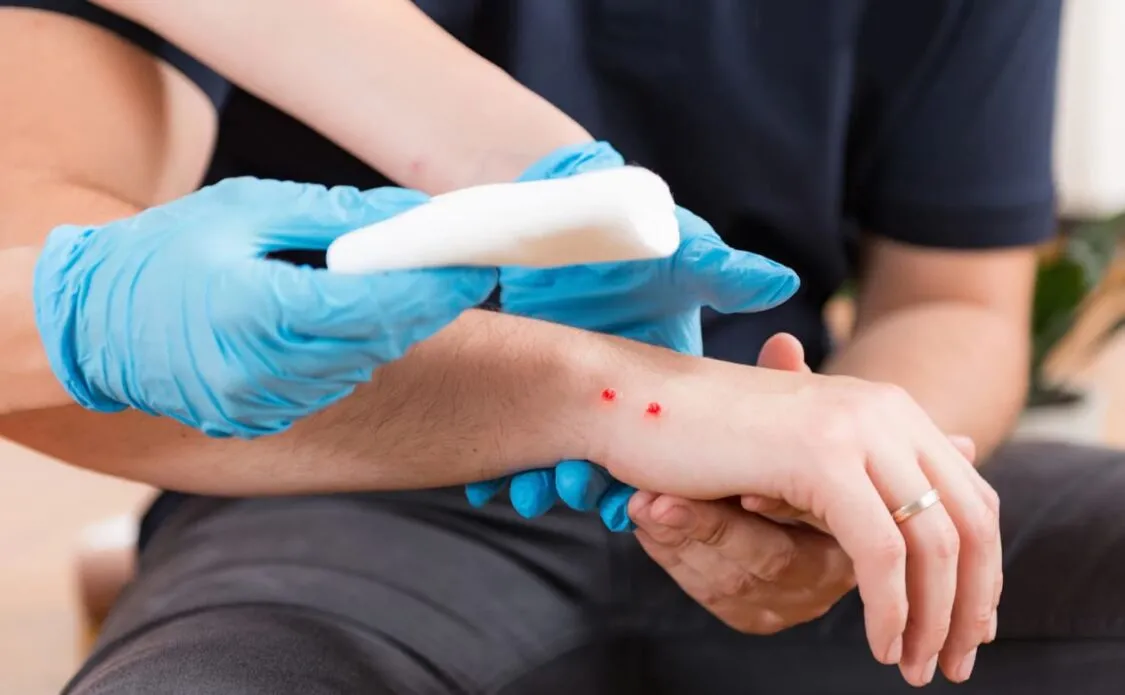 Giấc mơ bị rắn cắn chảy máu và cách hiểu theo ngữ cảnh