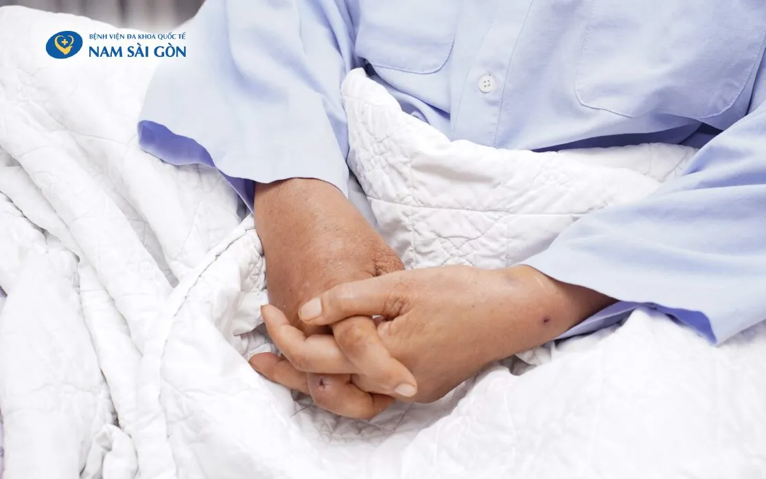 Vết ong đốt lặn dần sau điều trị và chăm sóc đúng cách